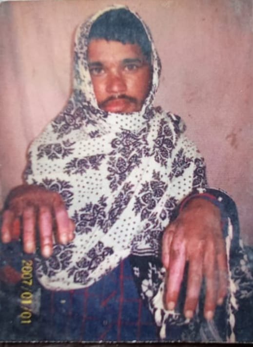 रोडवेज बस की टक्कर से दिव्यांग युवक की घटना स्थल पर दर्दनाक मौत।